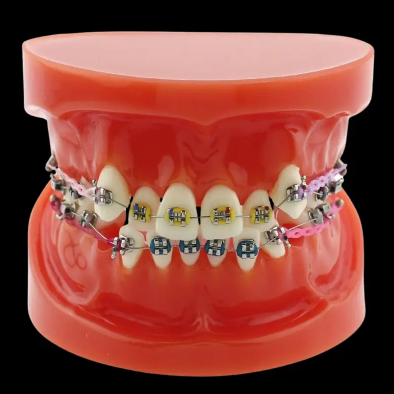 Orthodontic Models