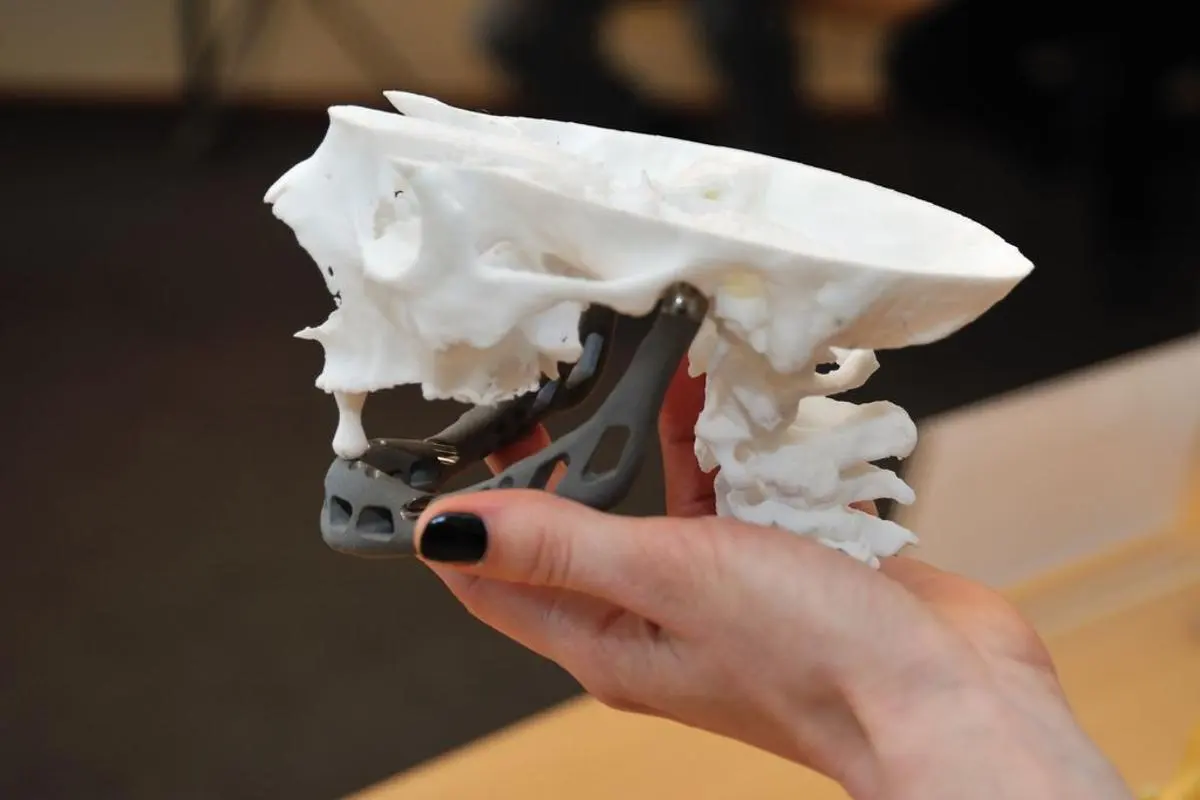 Prosthetics And Implants Dlp 3d Printing