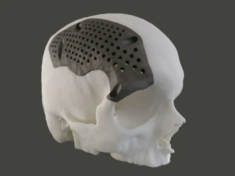 Medical Application For 3d Printing Case Study